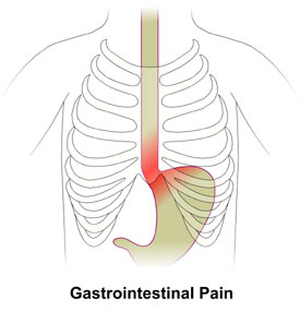 Gastrointestinal Pain